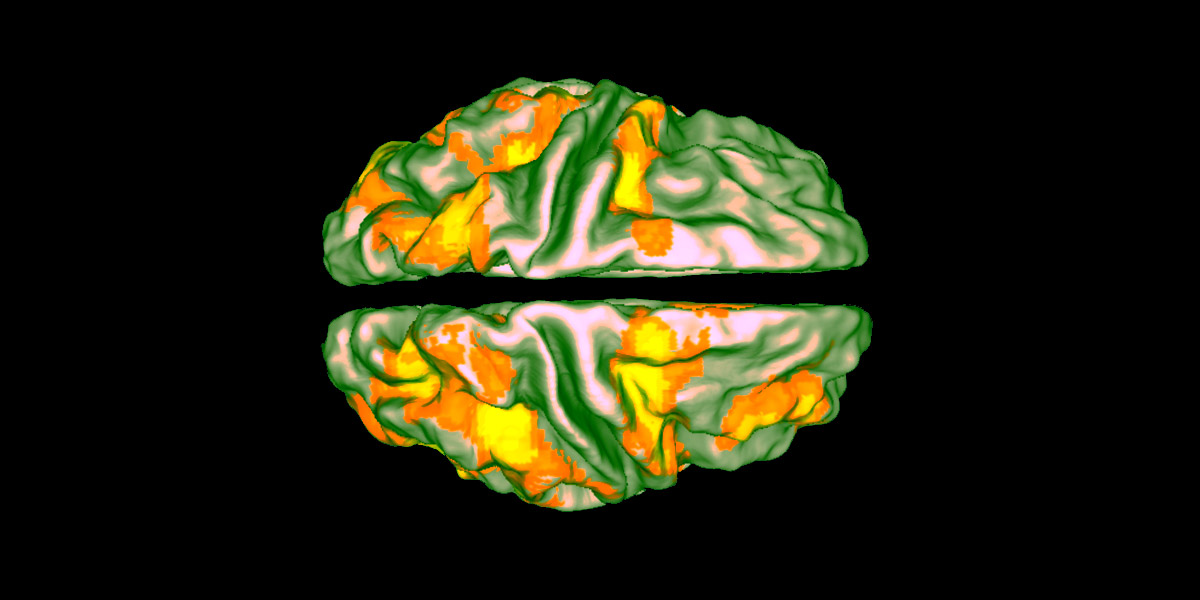 Intelligenza artificiale encefalogramma